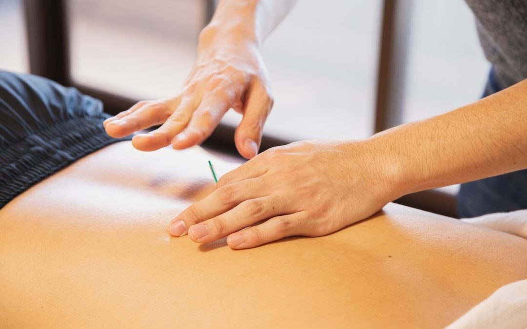 Dispelling Acupuncture Myths: What’s Fact and What’s Fiction?